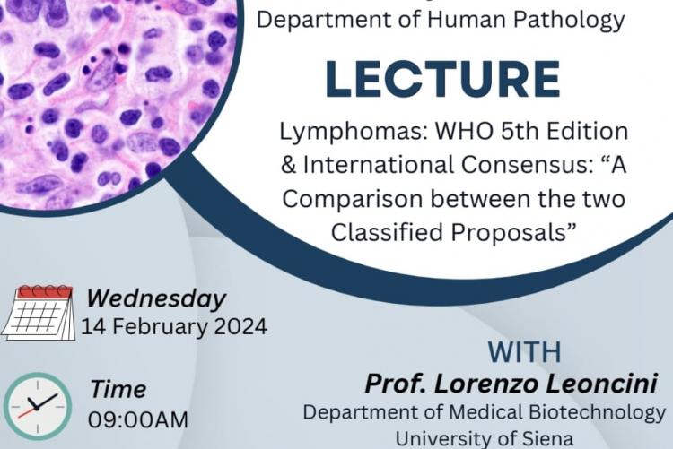 Lecture on Lymphoma by Prof Lorenzo