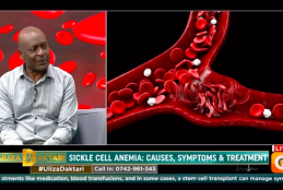 Prof Mwanda interview on Sickle Cell Anaemia